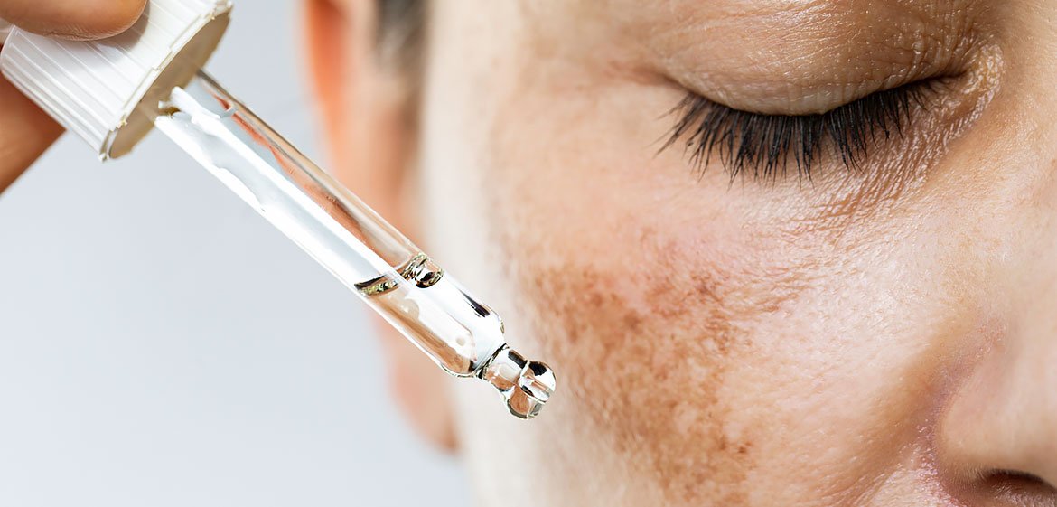 Halbseitiges Gesicht einer Frau, die mit geschlossenen Augen ein Retinoiden-Serum aufträgt.
